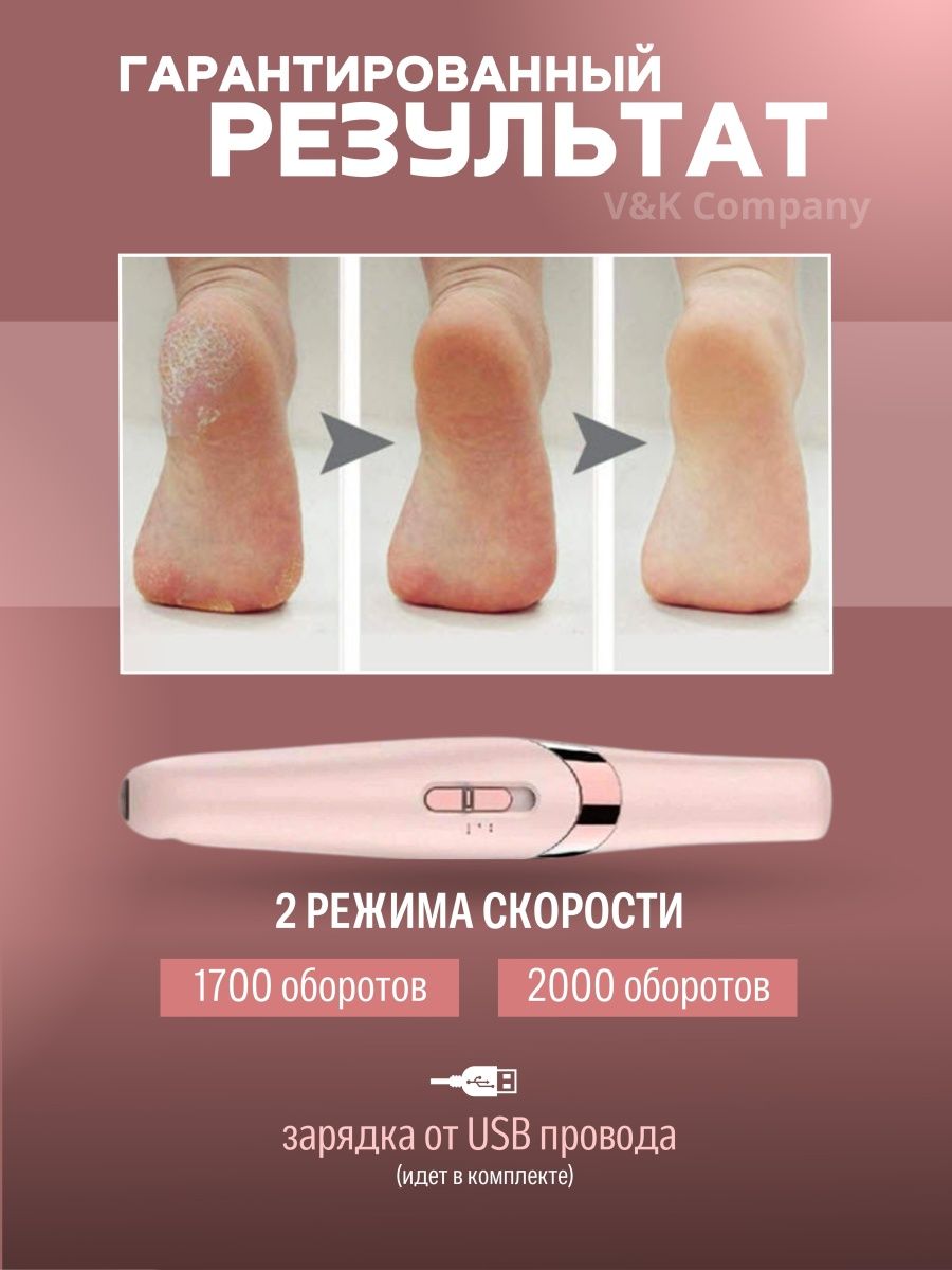 Электрическая пемза для пяток