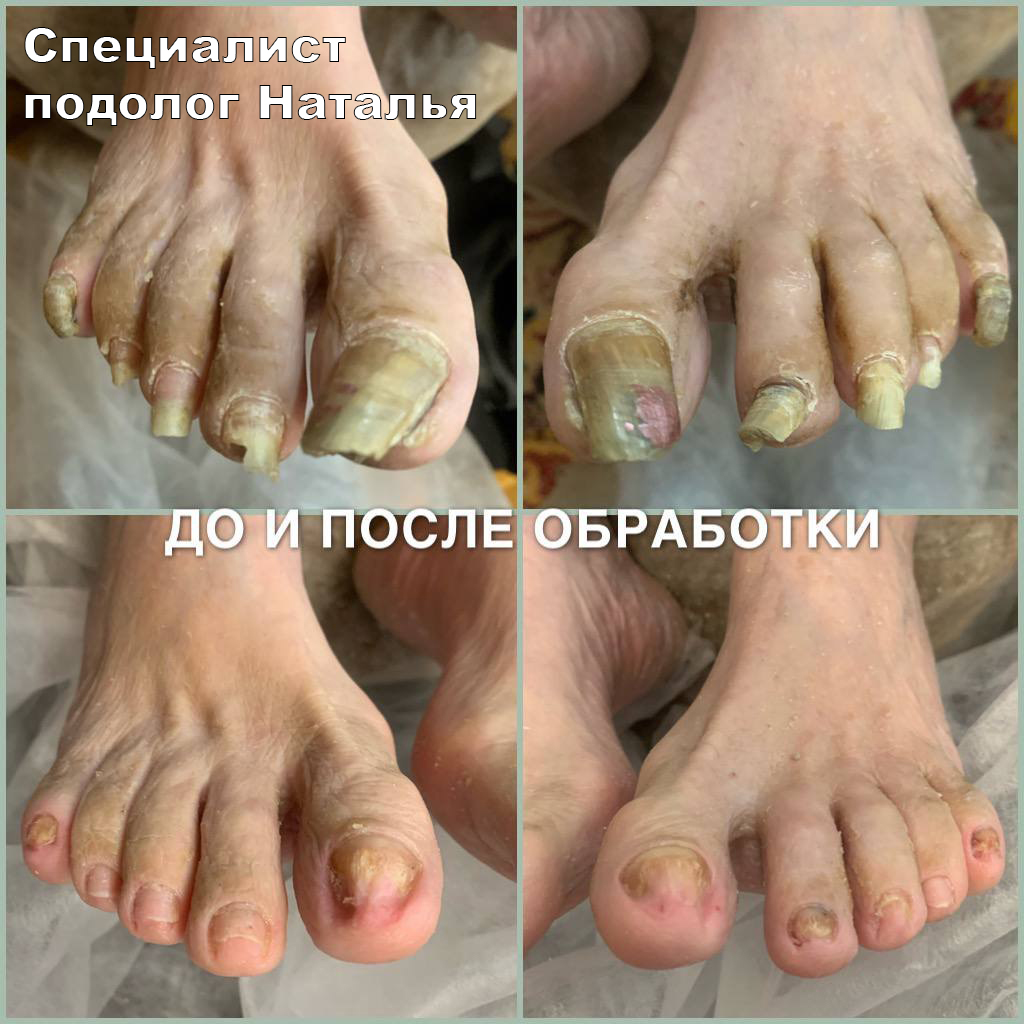 Nail_by_home. Кабинет здоровой стопы