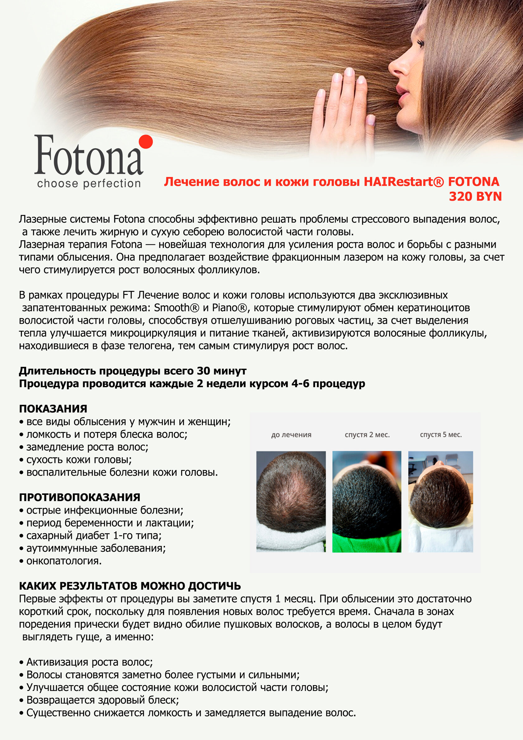 Лечение волос и кожи головы HAIRestart® FOTONA в Минске | Медицинский центр  ЭЛАР в Минске