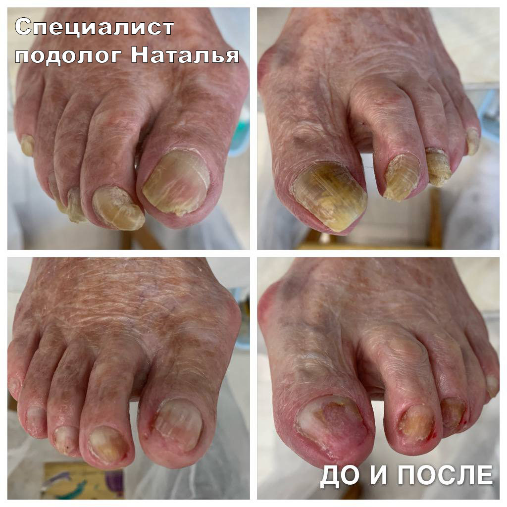 Nail_by_home. Кабинет здоровой стопы