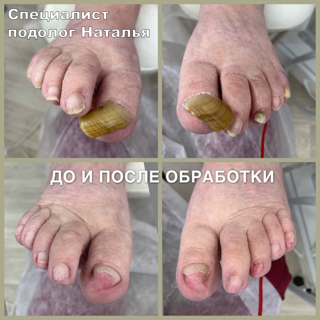 Nail_by_home. Кабинет здоровой стопы